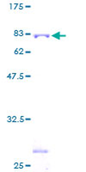 TRIM21 (Human) Recombinant Protein (P01)