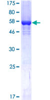 SRM (Human) Recombinant Protein (P01)