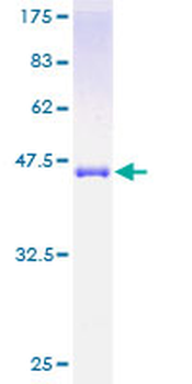 SRI (Human) Recombinant Protein (P01)