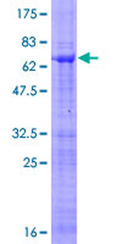 SPI1 (Human) Recombinant Protein (P01)