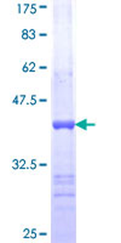 SPAM1 (Human) Recombinant Protein (Q01)