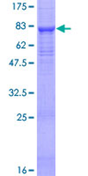 SPAM1 (Human) Recombinant Protein (P01)