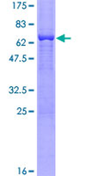 SORD (Human) Recombinant Protein (P02)