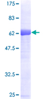 SORD (Human) Recombinant Protein (P01)