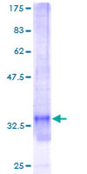 SNRPG (Human) Recombinant Protein (P01)