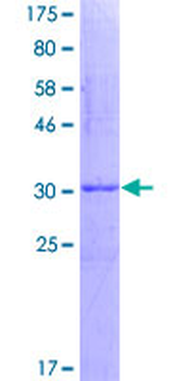 SNRPB (Human) Recombinant Protein (Q01)