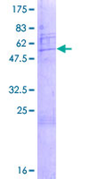 SNRPA1 (Human) Recombinant Protein (P01)