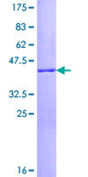 SNCG (Human) Recombinant Protein (P01)