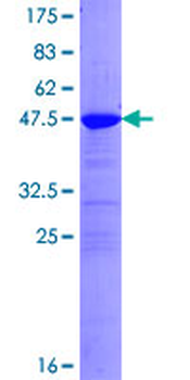 SNAP25 (Human) Recombinant Protein (P01)