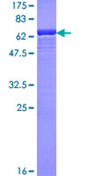 SMS (Human) Recombinant Protein (P01)
