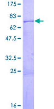 SMARCB1 (Human) Recombinant Protein (P01)