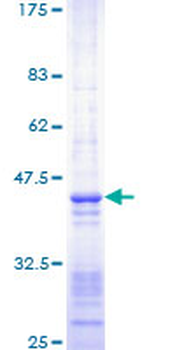 SMARCA4 (Human) Recombinant Protein (Q01)