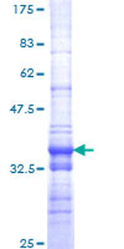 SMARCA2 (Human) Recombinant Protein (Q01)