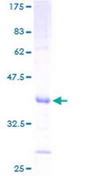SLPI (Human) Recombinant Protein (P01)