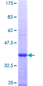SLC4A1 (Human) Recombinant Protein (Q01)