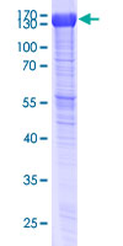 SLC4A1 (Human) Recombinant Protein (P01)