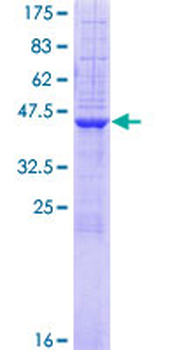 ST6GAL1 (Human) Recombinant Protein (P01)
