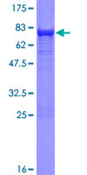 SHMT1 (Human) Recombinant Protein (P01)