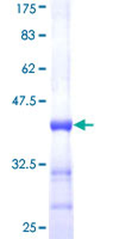 SHH (Human) Recombinant Protein (Q01)