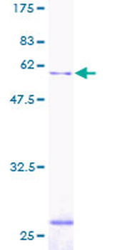 SGTA (Human) Recombinant Protein (P01)