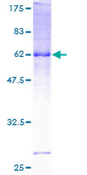 SGCD (Human) Recombinant Protein (P01)