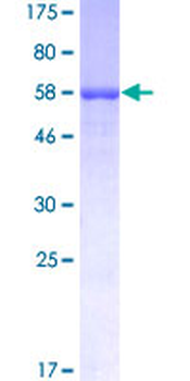 SFTPB (Human) Recombinant Protein (P01)