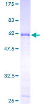 SFRP1 (Human) Recombinant Protein (P01)
