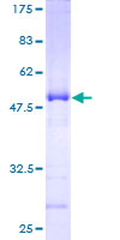 SDF2 (Human) Recombinant Protein (P01)