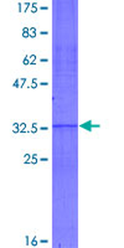 CXCL12 (Human) Recombinant Protein (P01)