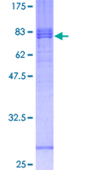 CX3CL1 (Human) Recombinant Protein (P01)