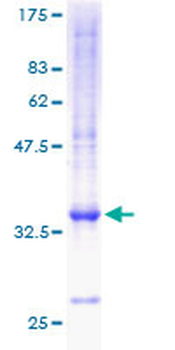 CXCL5 (Human) Recombinant Protein (P01)