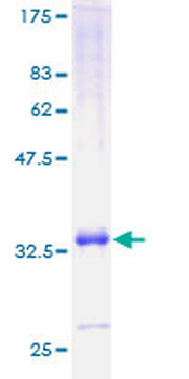 CXCL11 (Human) Recombinant Protein (P01)