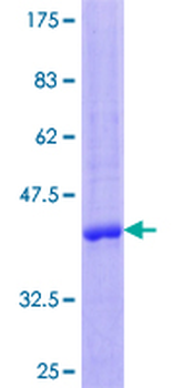 CCL23 (Human) Recombinant Protein (P01)