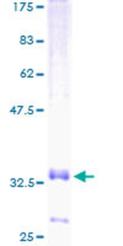 CCL20 (Human) Recombinant Protein (P01)