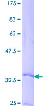 CCL19 (Human) Recombinant Protein (P02)