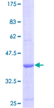 CCL19 (Human) Recombinant Protein (P01)