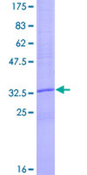 CCL18 (Human) Recombinant Protein (P01)