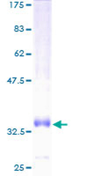 CCL14 (Human) Recombinant Protein (P01)