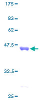 CCL13 (Human) Recombinant Protein (P01)