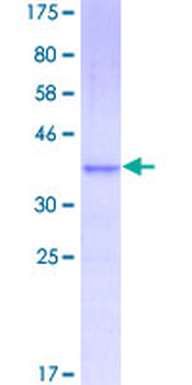 CCL11 (Human) Recombinant Protein (P01)