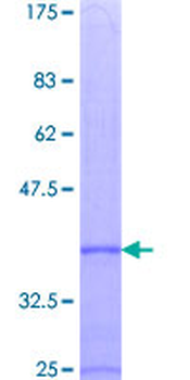 CCL7 (Human) Recombinant Protein (P01)