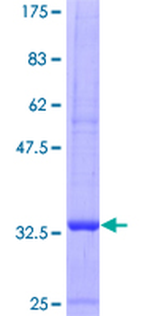 CCL5 (Human) Recombinant Protein (P01)