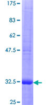 CCL3 (Human) Recombinant Protein (P01)