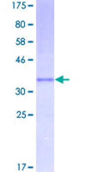 CCL2 (Human) Recombinant Protein (P01)