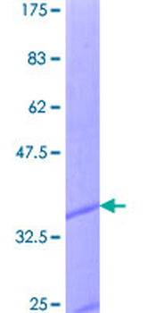 CCL1 (Human) Recombinant Protein (P01)