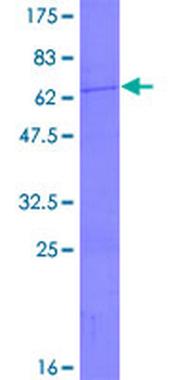 SCO1 (Human) Recombinant Protein (P01)