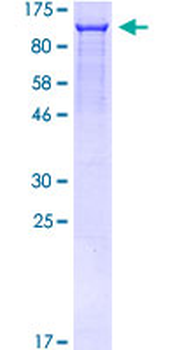 SATB1 (Human) Recombinant Protein (P01)