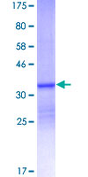 S100A12 (Human) Recombinant Protein (P02)