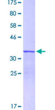 S100A12 (Human) Recombinant Protein (P01)