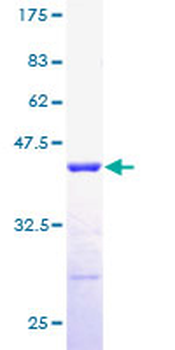 RPLP2 (Human) Recombinant Protein (P01)
